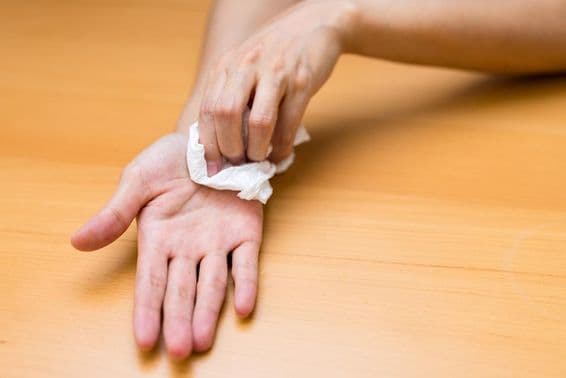 Nő szenved a kéz izzadságától.